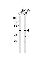 NR2F2 Antibody in Western Blot (WB)