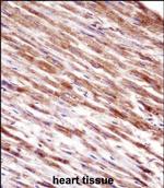 HSPBP1 Antibody in Immunohistochemistry (Paraffin) (IHC (P))