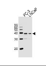 VDR Antibody in Western Blot (WB)