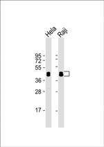 hnRNP D Antibody in Western Blot (WB)