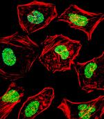 HAND2 Antibody in Immunocytochemistry (ICC/IF)