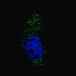 LC3A Antibody in Immunocytochemistry (ICC/IF)