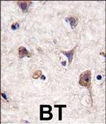 LC3A Antibody in Immunohistochemistry (Paraffin) (IHC (P))