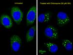 LC3B Antibody in Immunocytochemistry (ICC/IF)