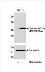 LC3A (Cleaved Gly120) Antibody in Western Blot (WB)