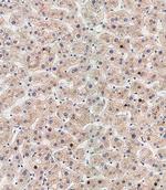 ATG5 Antibody in Immunohistochemistry (Paraffin) (IHC (P))