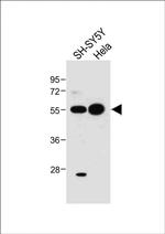 ATG5 Antibody in Western Blot (WB)