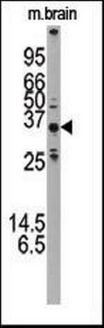 ATG5 Antibody in Western Blot (WB)