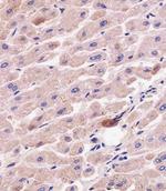 ATG7 Antibody in Immunohistochemistry (Paraffin) (IHC (P))