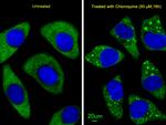 ATG7 Antibody in Immunocytochemistry (ICC/IF)