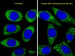 ATG16L1 Antibody in Immunocytochemistry (ICC/IF)