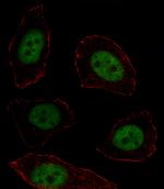 MSX1 Antibody in Immunocytochemistry (ICC/IF)