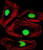 MBD2 Antibody in Immunocytochemistry (ICC/IF)