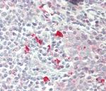 ZRSR2 Antibody in Immunohistochemistry (Paraffin) (IHC (P))