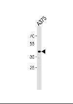 SIRPB1 Antibody in Western Blot (WB)