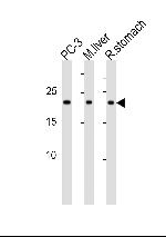 PSMB2 Antibody in Western Blot (WB)