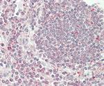 VAMP8 Antibody in Immunohistochemistry (Paraffin) (IHC (P))