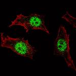 KLF4 Antibody in Immunocytochemistry (ICC/IF)