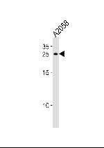 APRT Antibody in Western Blot (WB)