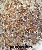 CD46 Antibody in Immunohistochemistry (Paraffin) (IHC (P))