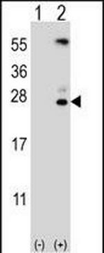 Kallikrein 6 Antibody in Western Blot (WB)