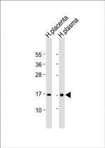 Transthyretin Antibody in Western Blot (WB)