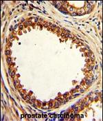 PTP4A2 Antibody in Immunohistochemistry (Paraffin) (IHC (P))