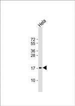 PTP4A2 Antibody in Western Blot (WB)