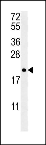 PTP4A2 Antibody in Western Blot (WB)