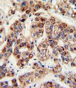 OTC Antibody in Immunohistochemistry (Paraffin) (IHC (P))