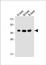 OTC Antibody in Western Blot (WB)