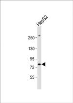 PIGR Antibody in Western Blot (WB)