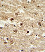 IGFBP2 Antibody in Immunohistochemistry (Paraffin) (IHC (P))