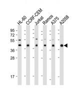 HLA-B Antibody in Western Blot (WB)