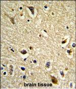 CYP2E1 Antibody in Immunohistochemistry (Paraffin) (IHC (P))