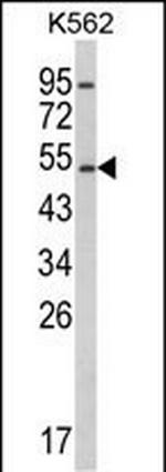 CYP2E1 Antibody in Western Blot (WB)