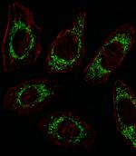 OAT Antibody in Immunocytochemistry (ICC/IF)