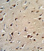 OAT Antibody in Immunohistochemistry (Paraffin) (IHC (P))