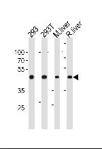 OAT Antibody in Western Blot (WB)