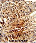 PIN1 Antibody in Immunohistochemistry (Paraffin) (IHC (P))