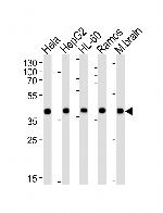 GOT2 Antibody in Western Blot (WB)