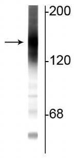 Adenylate Cyclase 3 Antibody in Western Blot (WB)