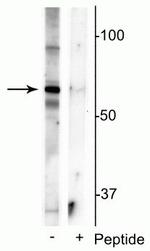 Phospho-MECP2 (Ser421) Antibody in Western Blot (WB)