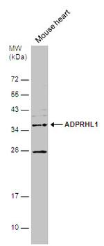 ADPRHL1 Antibody in Western Blot (WB)