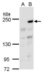 ARID2 Antibody in Western Blot (WB)