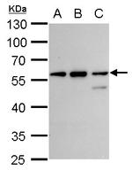 CLN3 Antibody in Western Blot (WB)