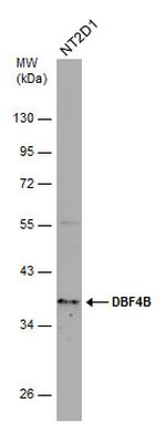 DBF4B Antibody in Western Blot (WB)