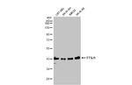 FTSJ1 Antibody in Western Blot (WB)