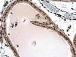 Histone H1.3 Antibody in Immunohistochemistry (Paraffin) (IHC (P))