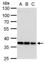 HOXD13 Antibody in Western Blot (WB)